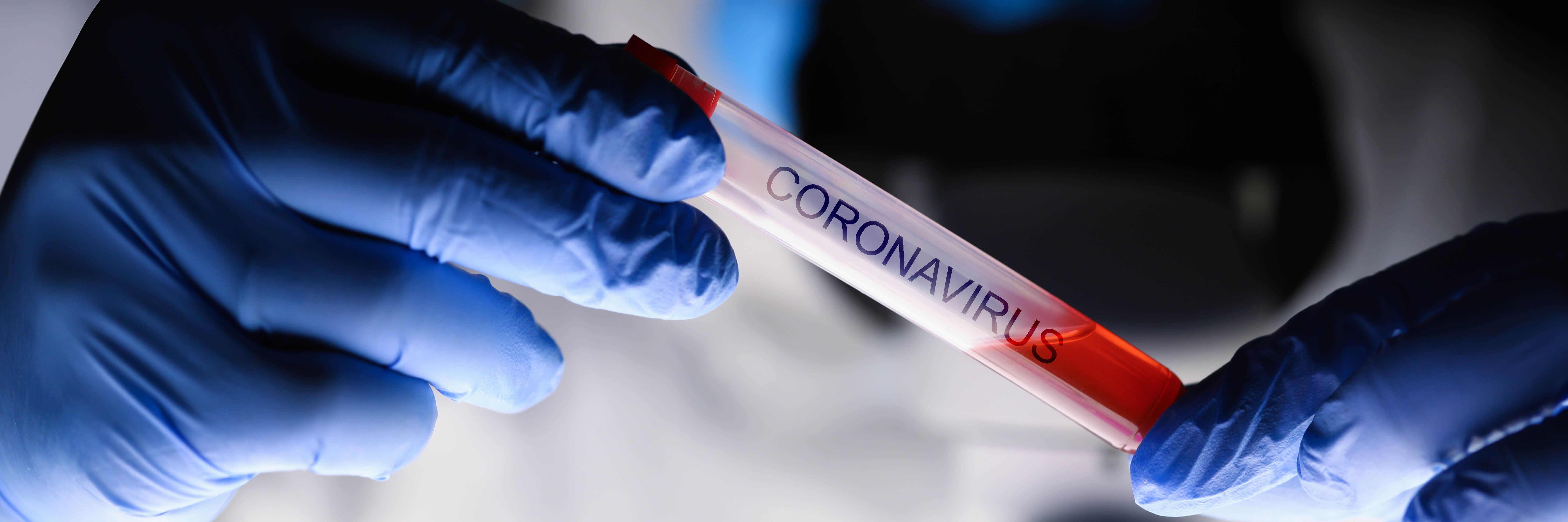 SARS-CoV-2 & COVID-19 - unsere Experten informieren SARS-CoV-2 & COVID-19 - unsere Experten informieren